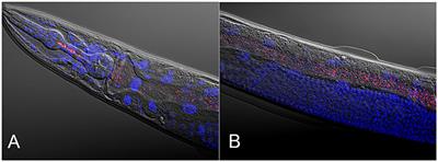 Caenorhabditis elegans as a Model for Microbiome Research